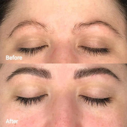 Veonne™ Micro-Infusion Brow Kit