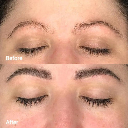 Veonne™ Micro-Infusion Brow Kit