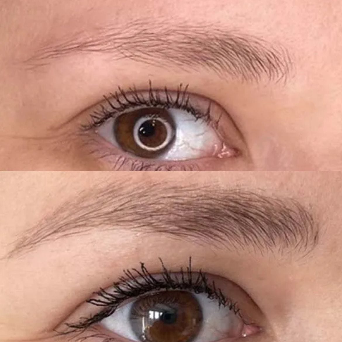 Veonne™ Micro-Infusion Brow Kit