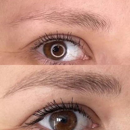 Veonne™ Micro-Infusion Brow Kit